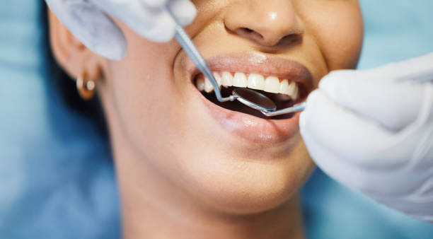 Best Emergency Tooth Extraction in Belle Fourche, SD
