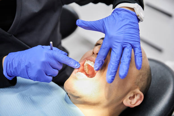 Best Emergency Dental Care for Broken or Chipped Teeth in Belle Fourche, SD